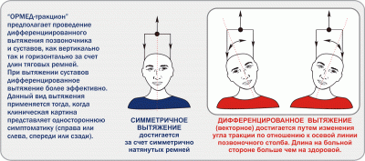 Тракционное оборудование ОРМЕД-Тракцион